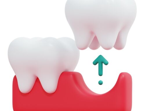 What Age Do Wisdom Teeth Start Growing?